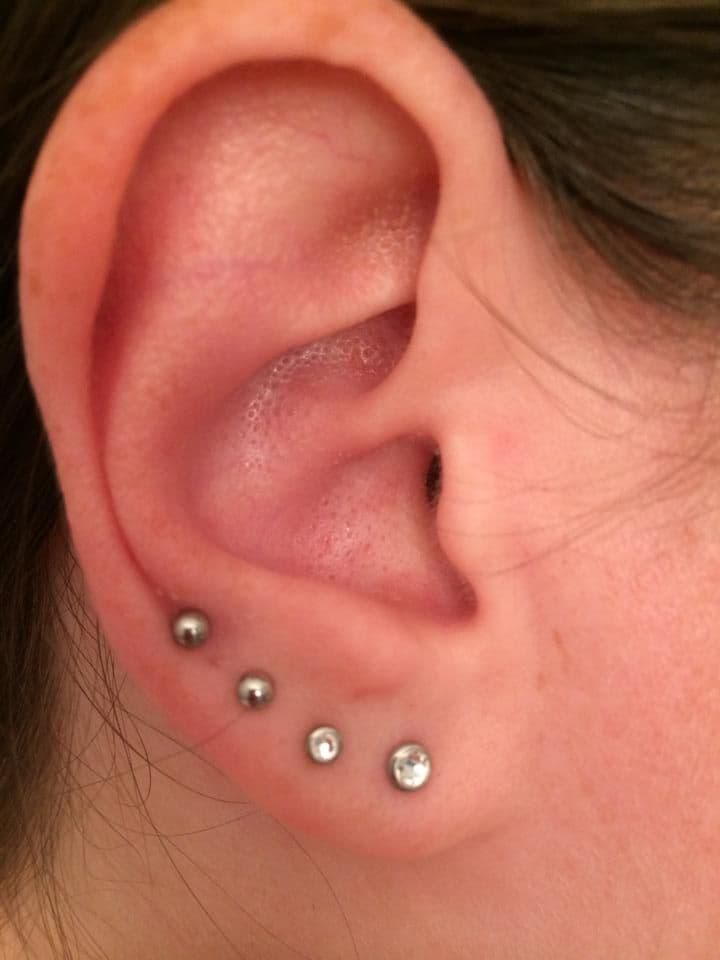 Any Lobe