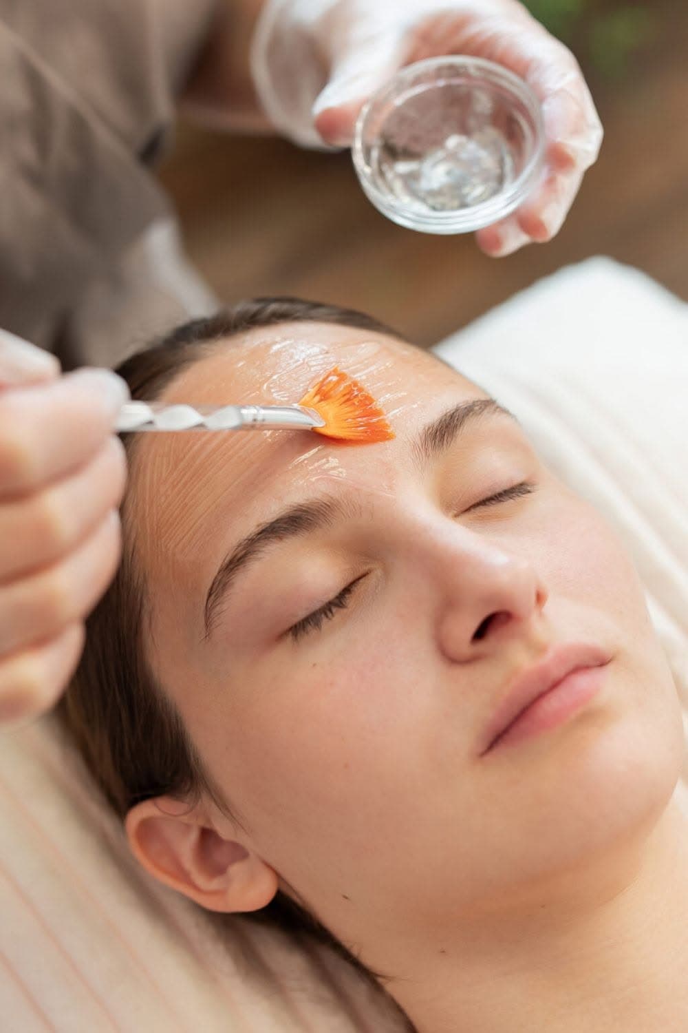 Diamond Peel w/ Laser